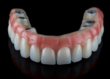 Upper implant denture